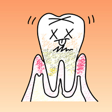 歯周病と糖尿病